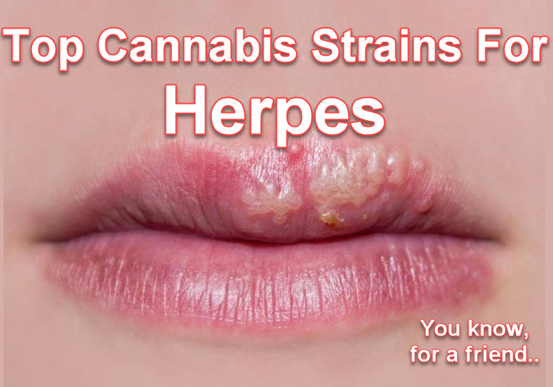 top-cannabis-strains-for-herpes