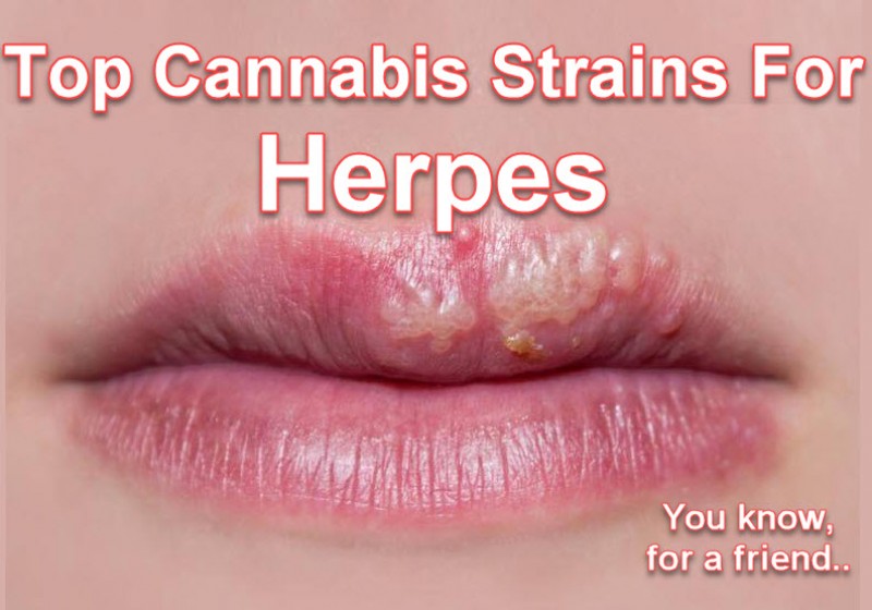 cannabis for herpes
