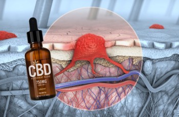 CBD Restricts Tumor Growth in Cancer Patients Say New Medical Studies