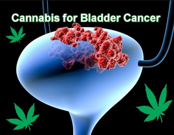 Cannabis for Bladder Cancer