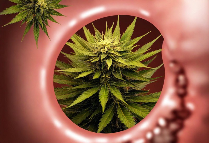 cannabis causes colon cancer?