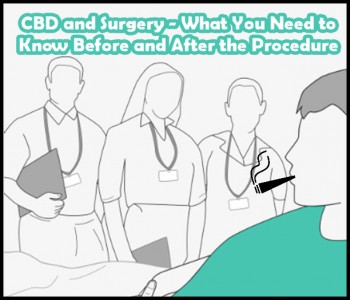 CBD and Surgery - What You Need to Know Before and After the Procedure