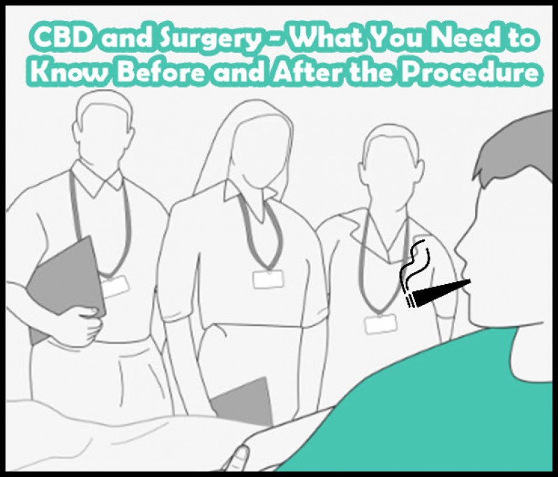 cbd pre and post surgery