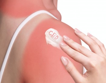 It's Getting Hot Outside, Does CBD Help with a Sunburn?