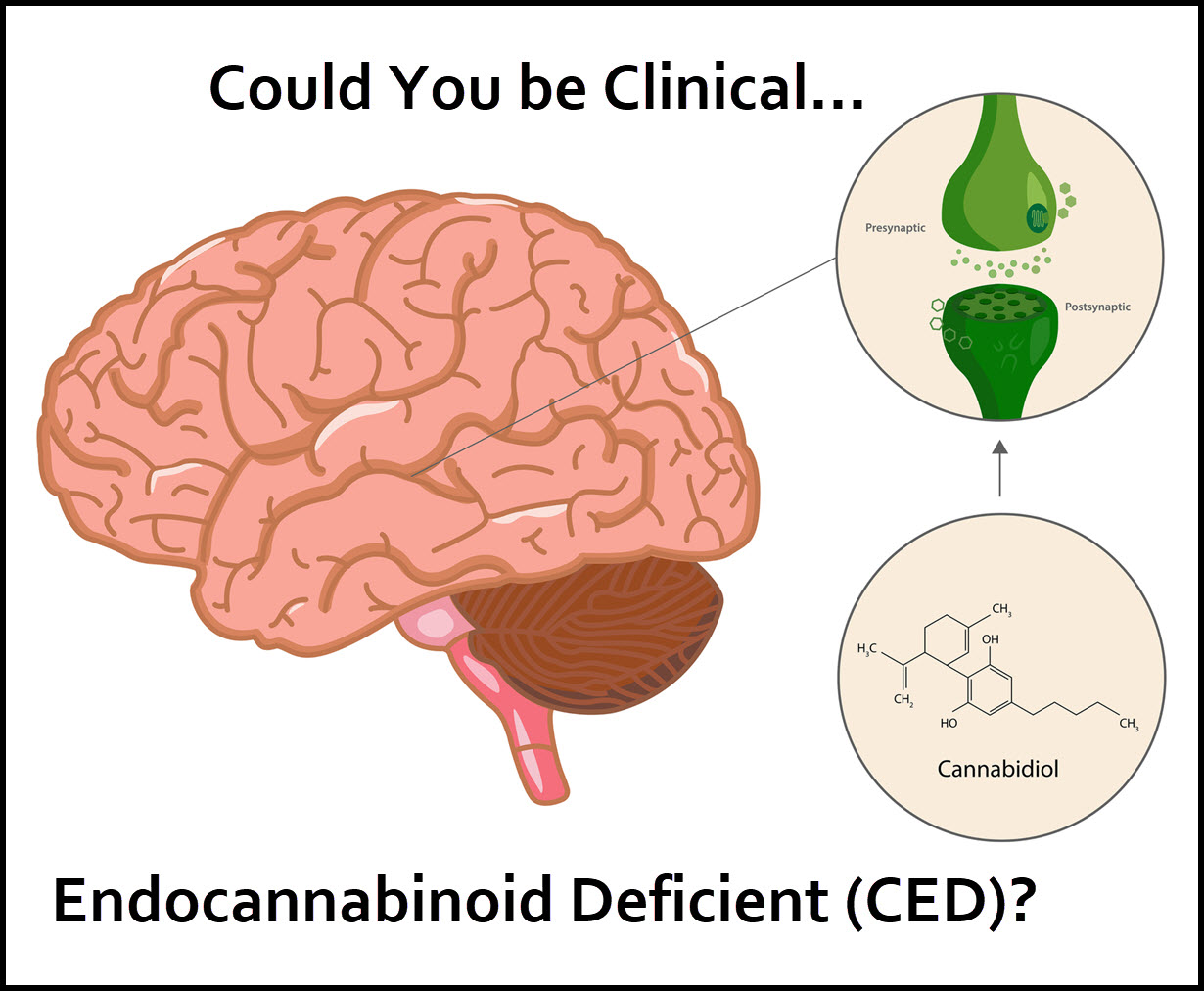 Could You Be Clinical Endocannabinoid Deficient (CED)?