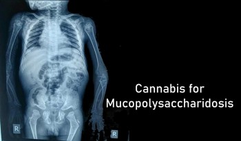 Cannabis For Mucopolysaccharidosis (Hurler Syndrome)