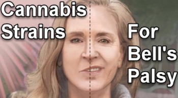 Top Cannabis Strains for Bell’s Palsy