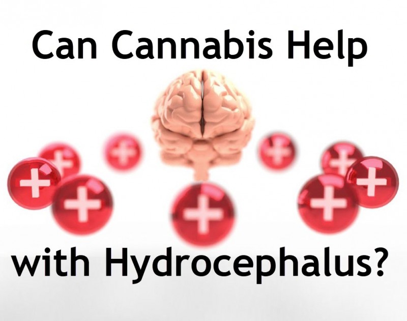 cannabis hydrocephalus
