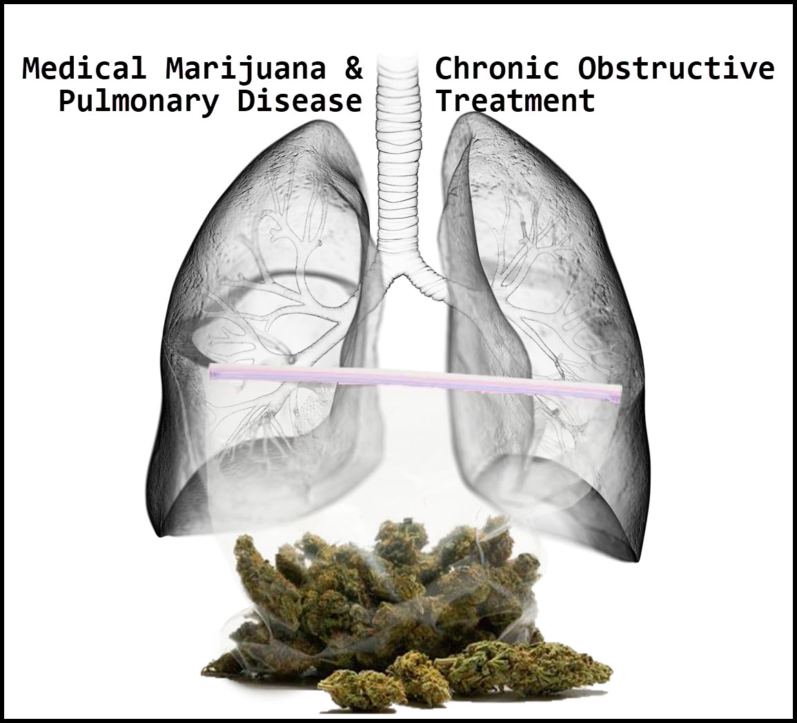 Medical Marijuana And Chronic Obstructive Pulmonary Disease Treatment