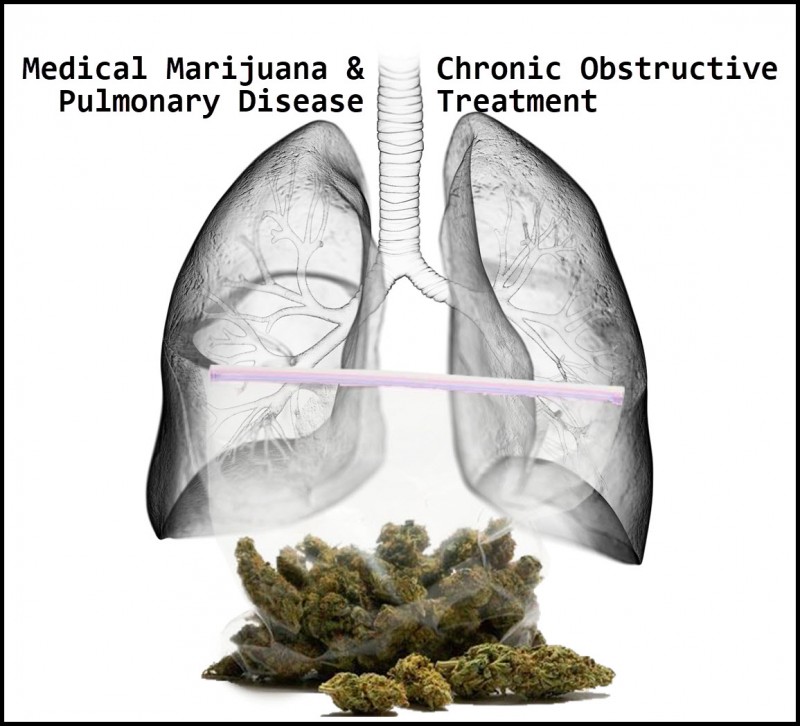 marijuana for COPD