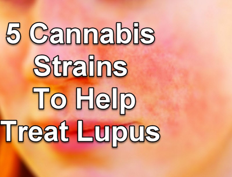 cannabis strains for lupus