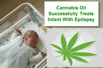 Cannabis Oil Successfully Treats Infant With Epilepsy