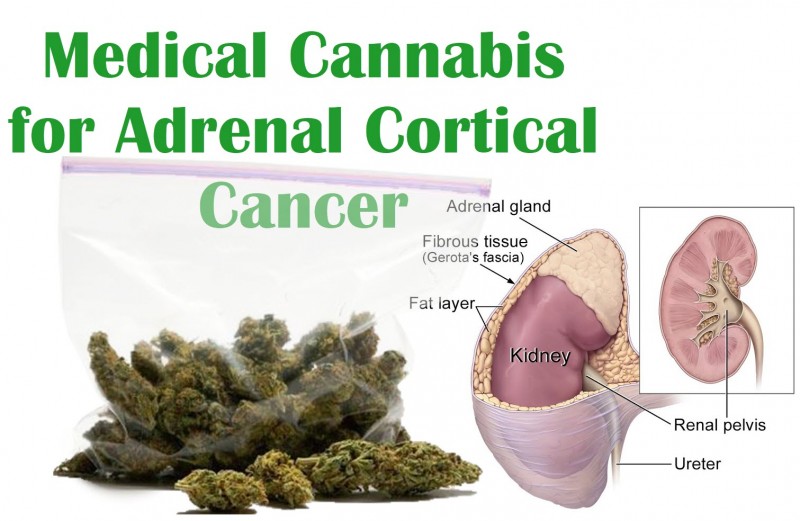 adrenal cortical cancer and marijuana