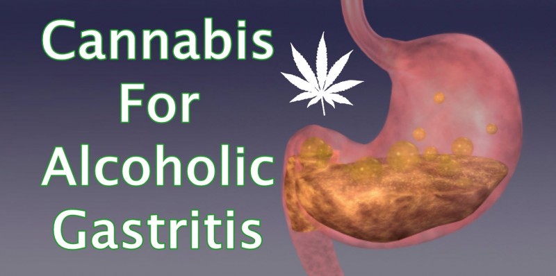 cannabis for gastritis