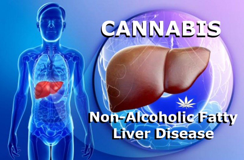 cannabis for non fatty liver disease