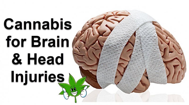 cannabis and the brain