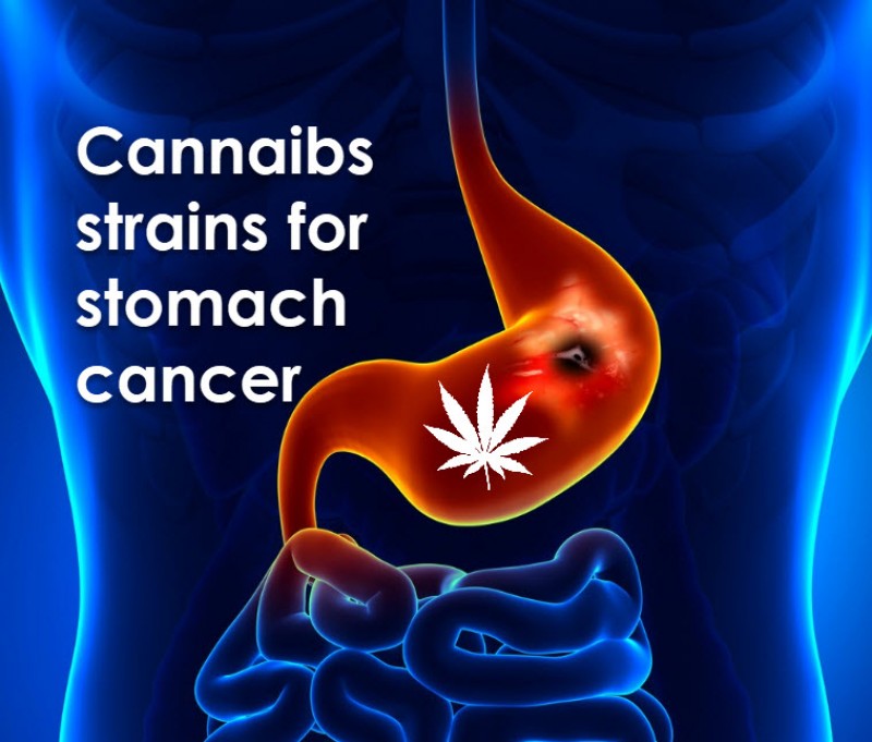 cannabis strain for stomach cancer
