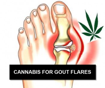 Cannabis For Gout - Why Medical Marijuana Helps Arthritis
