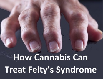 How Cannabis Can Treat Felty’s Syndrome