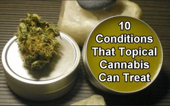 10 Conditions That Topical Cannabis Can Treat