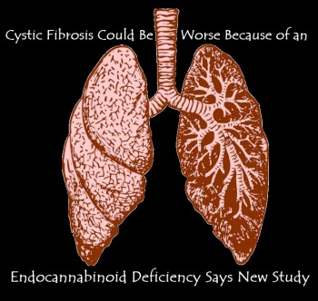 Cystic Fibrosis Could Be Worse Because of an Endocannabinoid Deficiency Says New Study