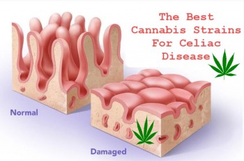 Top Cannabis Strains for Celiac Disease