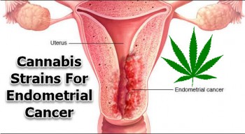Cannabis Strains For Endometrial Cancer