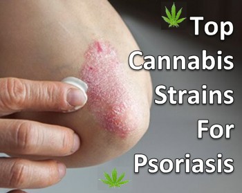 Top Cannabis Strains For Psoriasis