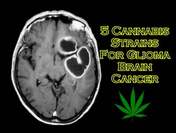 5 Cannabis Strains For Glioma Brain Cancer