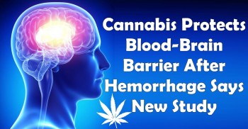 Cannabis Protects Blood-Brain Barrier After Hemorrhage Says New Study