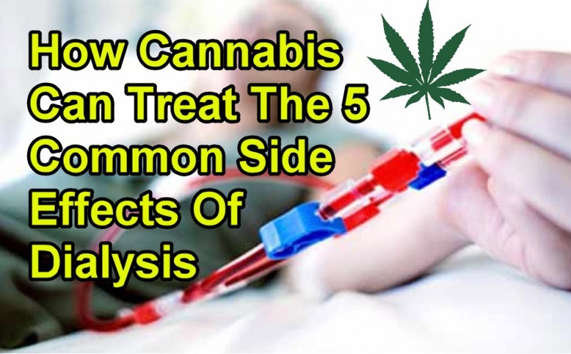 cannabis dialysis