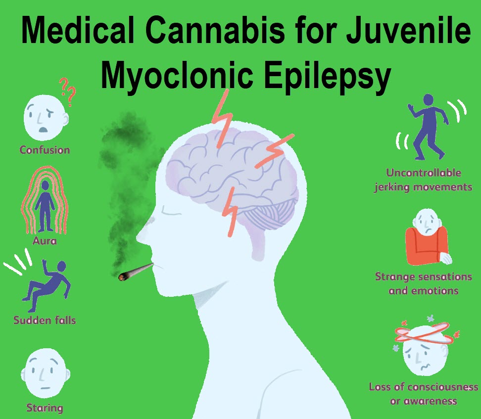 cannabis for nocturnal epilepsy