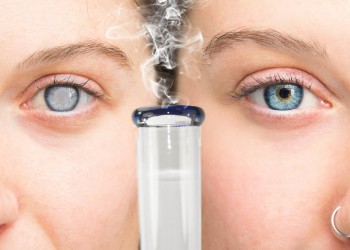 Does Cannabis Work for Glaucoma? - What the Lastest Studies Say!