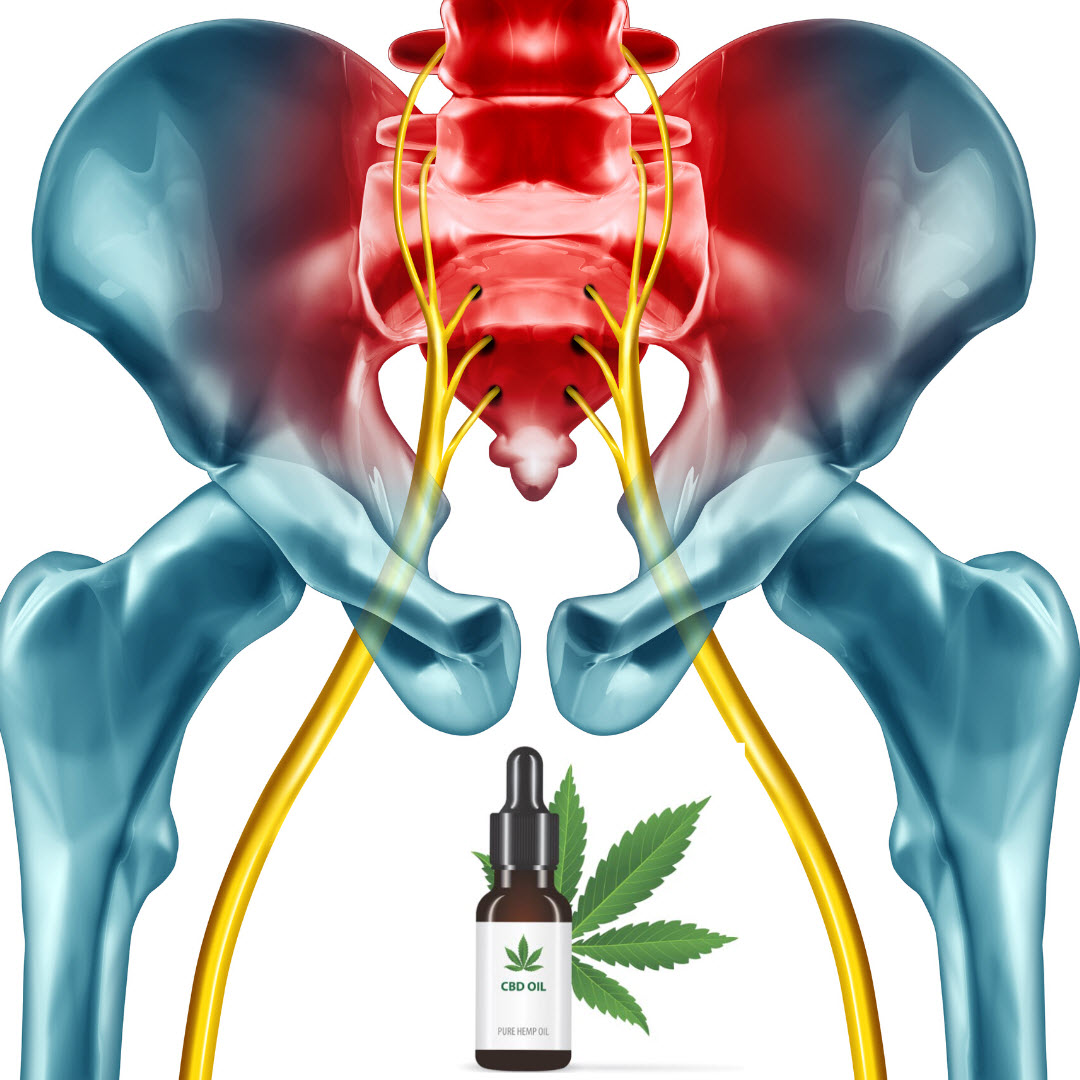 8 Amazing Benefits of CBD Oil for Sciatica Nerve Pain
