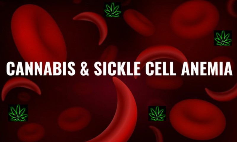 Cannabis Sickle Cell Anemia Pain