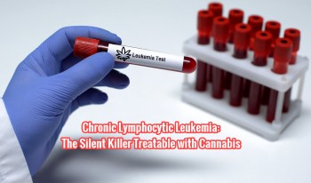 Chronic Lymphocytic Leukemia: The Silent Killer Treatable with Cannabis