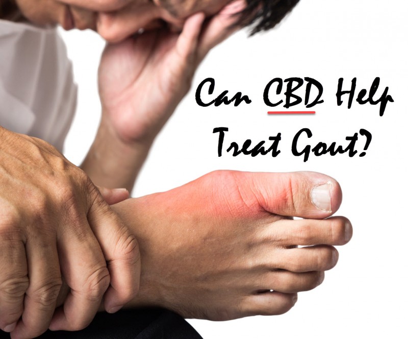 Can CBD Treat Gout