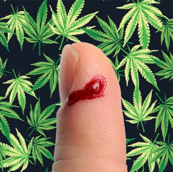 Cannabis Oil Helps Skin Wounds and Cuts Heal Faster According to New Skin Research Report