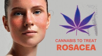 Cannabis For Rosacea