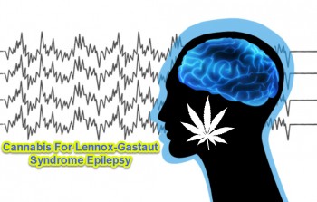 Cannabis For Lennox-Gastaut Syndrome Epilepsy