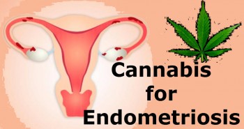 Cannabis for Endometriosis