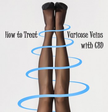 How to Treat Varicose Veins with CBD
