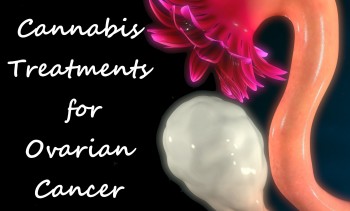 Cannabis Treatments for Ovarian Cancer Patients