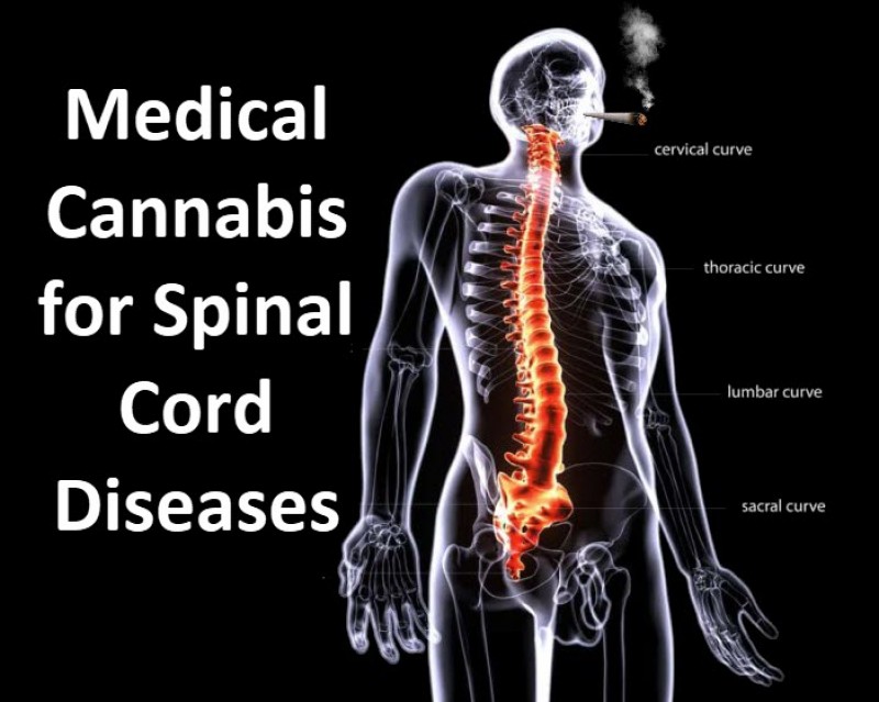 medical marijuana and spinal cords