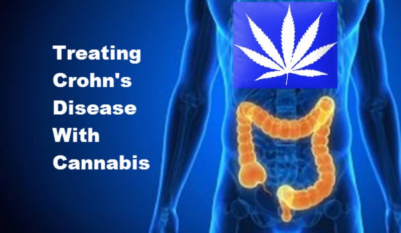 Cannabis For Crohn's