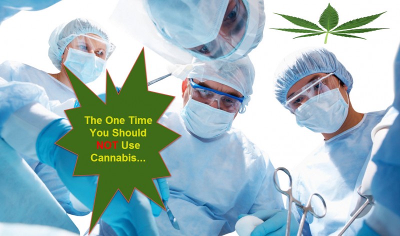 cannabis before surgery