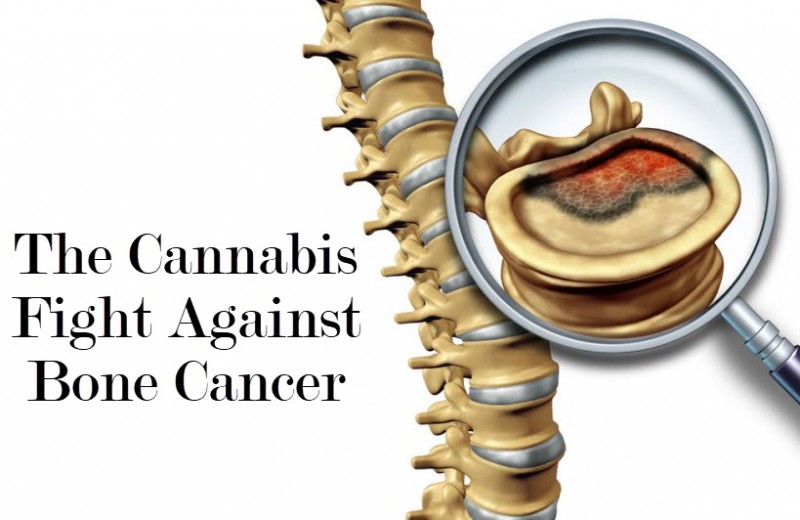 cannabis and bone cancer