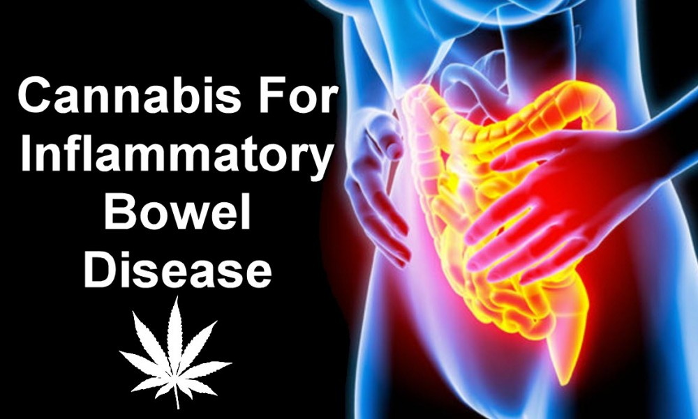 IBS BOWEL CANNABIS