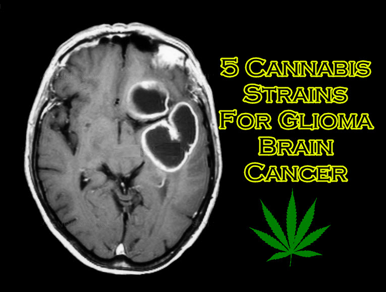 cannabis strains for brain cancer