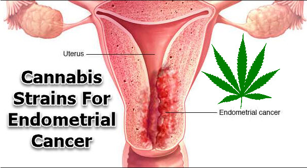 cananbis for endometrial cancer